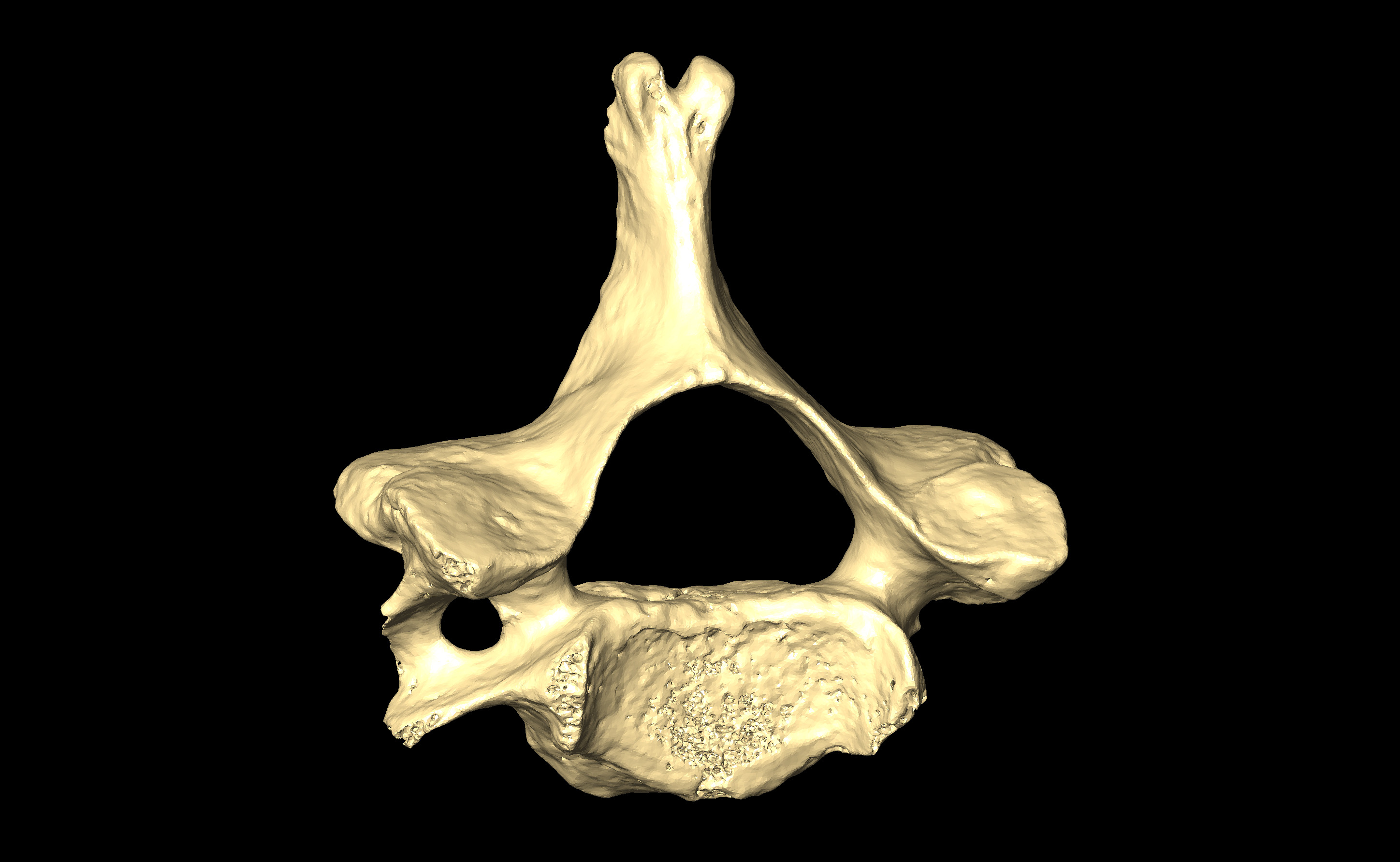 MNHN-HA-4260 Cervical Vertebra