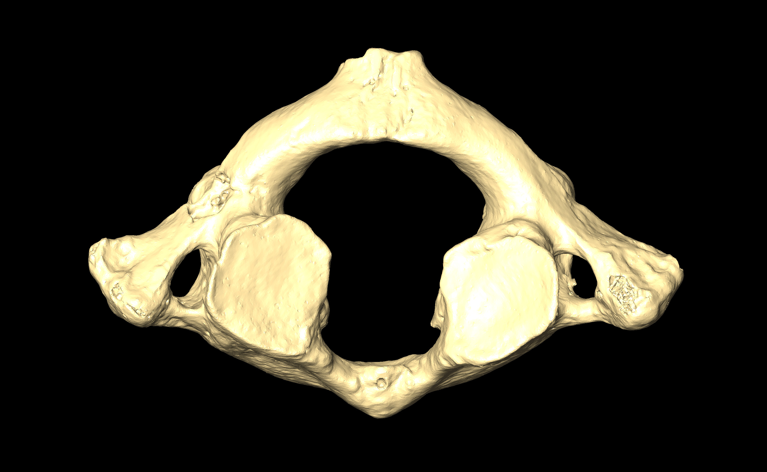 MNHN-HA-4271 Cervical Vertebra 1