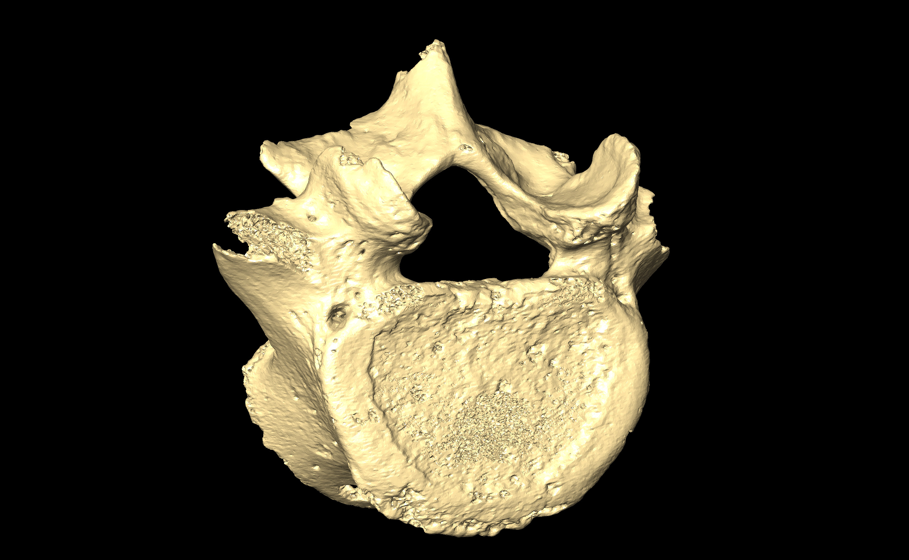 MNHN-HA-4281 Lumbar Vertebra 5