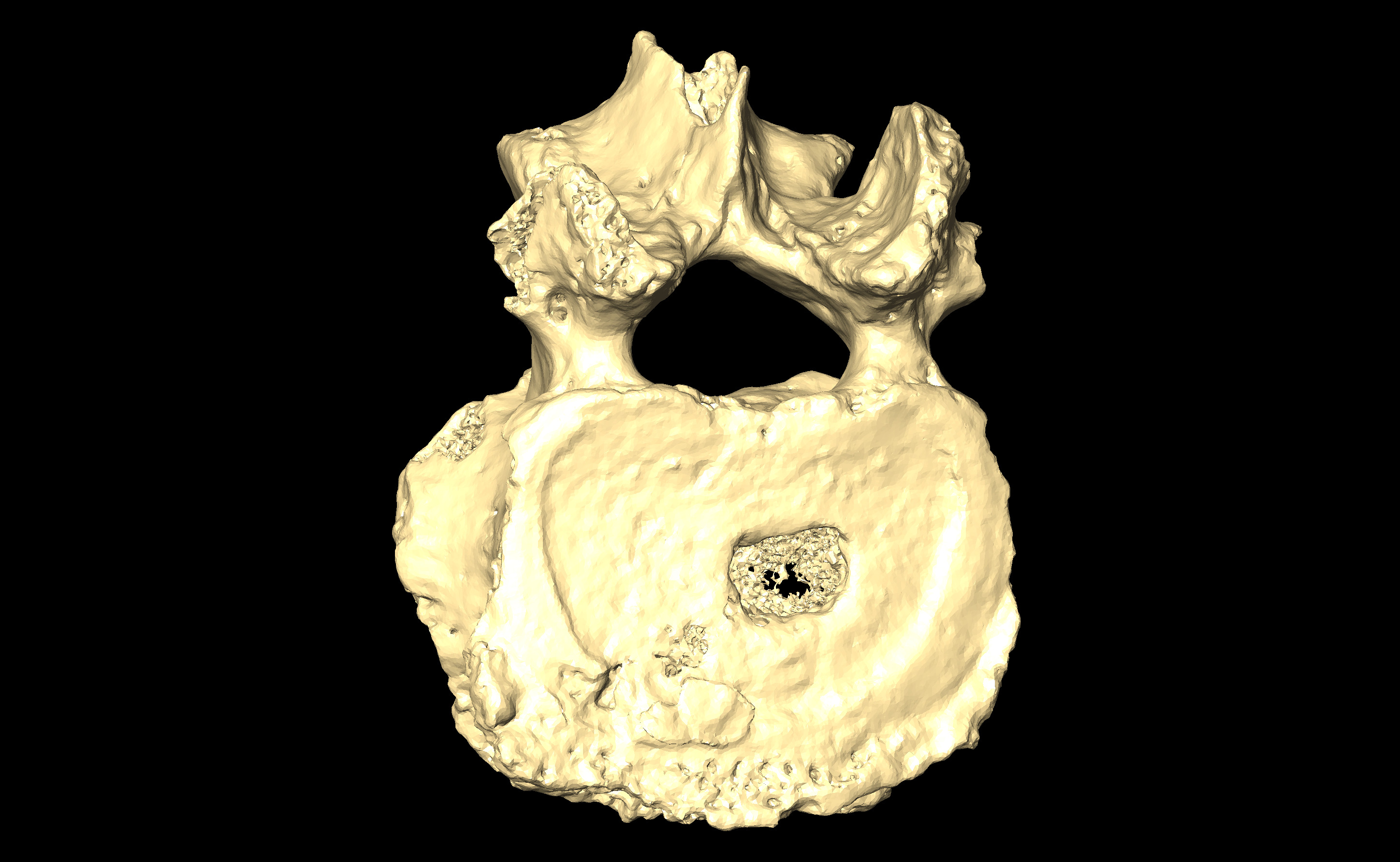 MNHN-HA-4286 Lumbar Vertebra 2